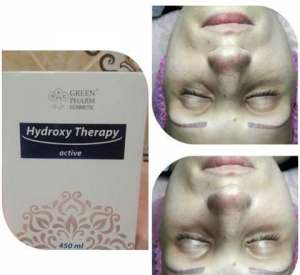    , - - 