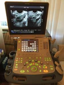   : Esaote MyLab X-Vision 2011 .