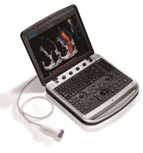   Chison SonoBook 9