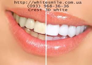  crest 3d whiteWhitestrips crest whitestrips,. - 