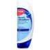   Head&Shoulders   180  ,   .