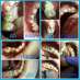   Multident  
