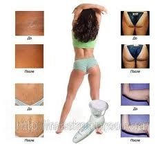 Celluless ��������� �������� ��������