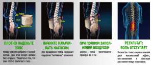 Spinal Doctor NEW      - 