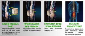Spinal Doctor NEW Лучшее ортопедическое решение проблем позвоночника - объявление