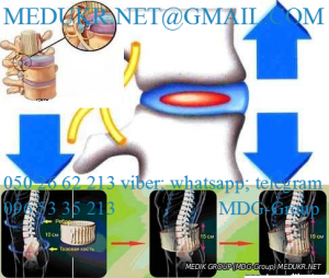 SPINALDOCTOR       ..:0957712620;0679758242;0938751414 - 