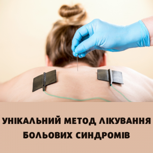 Внутрішньотканинна електростимуляції (ВТЕС) - объявление