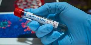 Выезд медсестры для забора теста на ковид19 домой и офис - объявление
