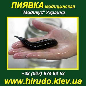 Гирудотерапия 2014-2015 Пиявки медицинские Киев - объявление