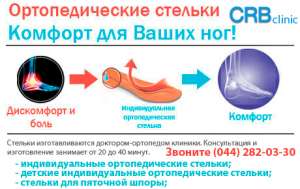 Индивидуальные ортопедические стельки - объявление