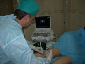 Как лечить варикоз - оголошення