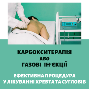 Карбокситерапія або газові уколи - сучасний метод лікування! - объявление