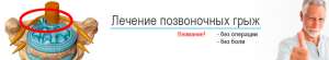 Лечение межпозвоночной грыжи без операции - оголошення