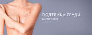 Мастопексия Киев. Подтяжка груди у Андрея Харькова. - объявление