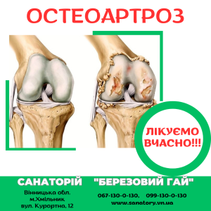 Остеоартроз - лікуємо вчасно! - объявление