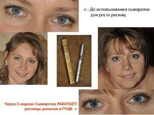 Питательная сыворотка для роста ресниц