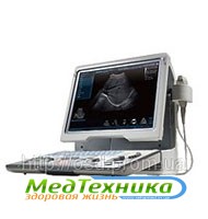 Портативный УЗИ аппарат Mindray DP-50 - объявление