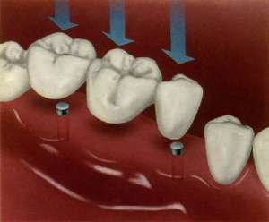 Современное лечение зубов - оголошення