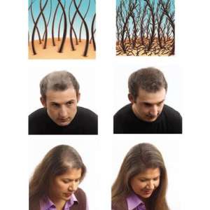 Топпик (Toppik) и HairSoReal – это загуститель для редеющих волос, залысин,при облысении. - оголошення