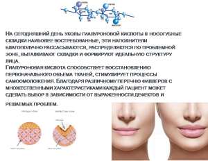 Филлеры "HYAFILIA" - объявление
