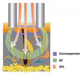 ���� ��������