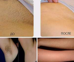 ���� ��������