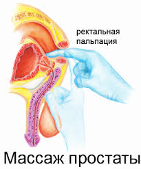 ������ ��� ������