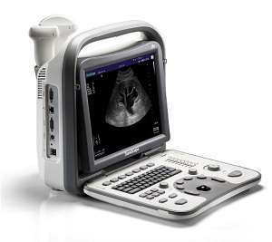 ������ ������� ��� SonoScape A6 - �/� + 2 ������� - ����������