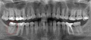 ������� �����