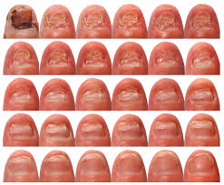 ������� ������ ������