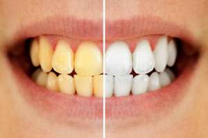 ���������� ���������� ����� �������� Beyond Polus, ����� - ����������