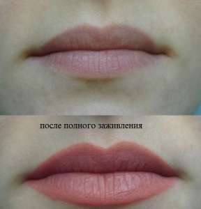 ������-����� �����������!!!