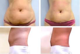 ����������� / �������������