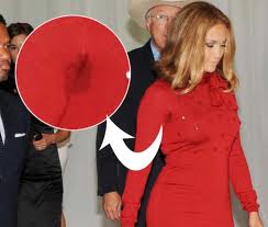 ������������ (����������) (��������� �� ����), ������ ������, ��������, ������� - ����������